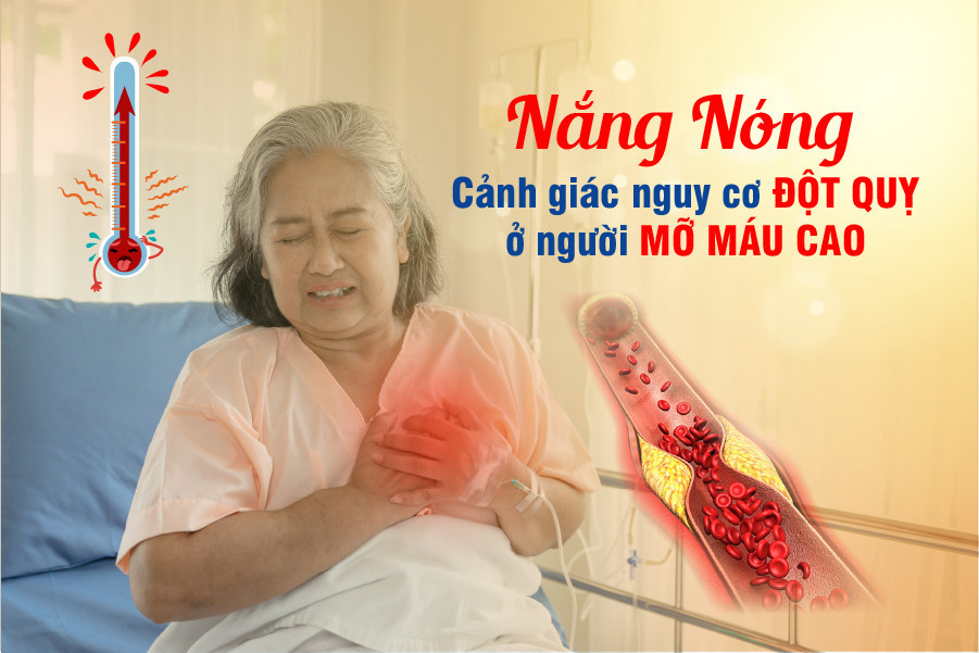 Mỡ máu cao: Cẩn trọng đột quỵ do nắng nóng