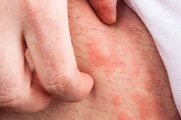 Mắc bệnh tế nhị sau một lần 'vui vẻ' cùng người lạ trong chuyến công tác