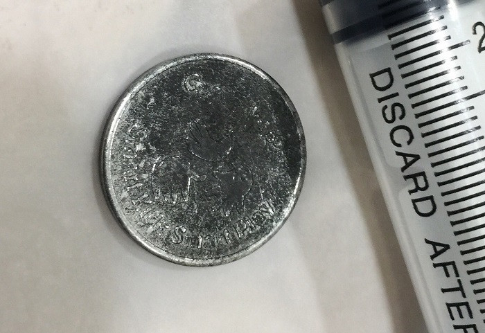 Nuốt đồng xu trong lúc chơi đùa, bé gái 4 tuổi nhập viện