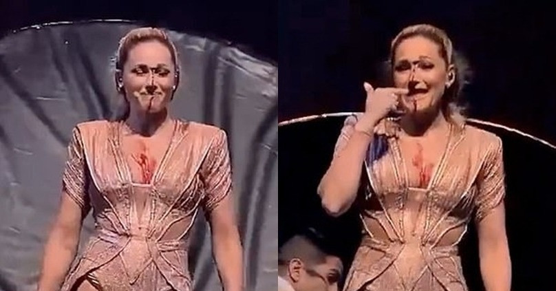 Ca sĩ nổi tiếng bị ngã đập đầu trên sân khấu, rách mặt vẫn cố diễn