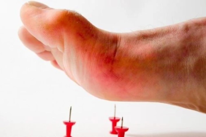 Nam thanh niên suýt chết vì vết thương rất nhỏ ở bàn chân