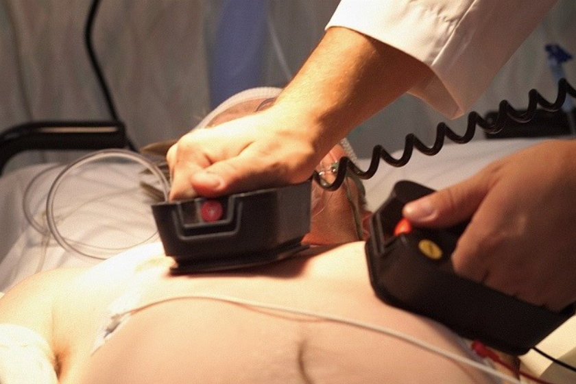 Sốc điện 12 lần cứu người phụ nữ đã ngừng tim