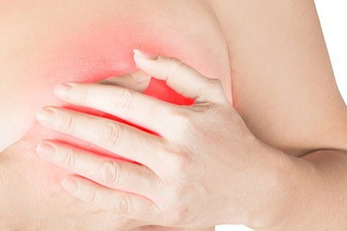 Phát hiện ung thư sau 5 tháng ngực chảy dịch bất thường