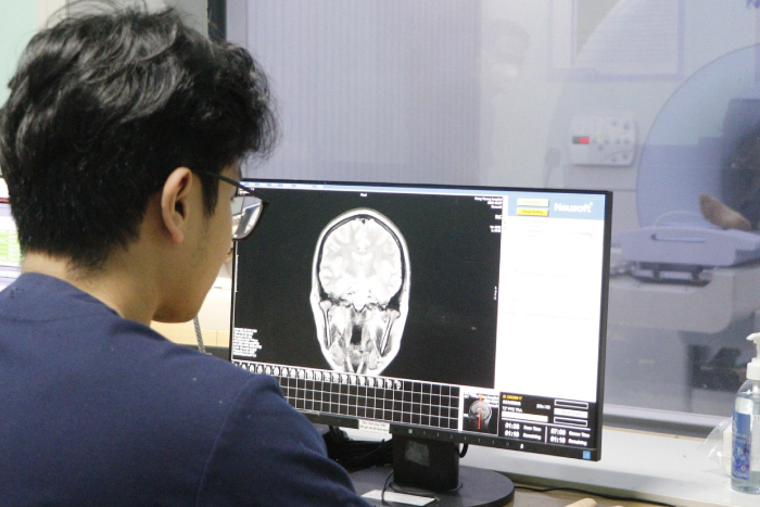 Từ cơn đau đầu, nam bệnh nhân 32 tuổi bị đột quỵ nặng