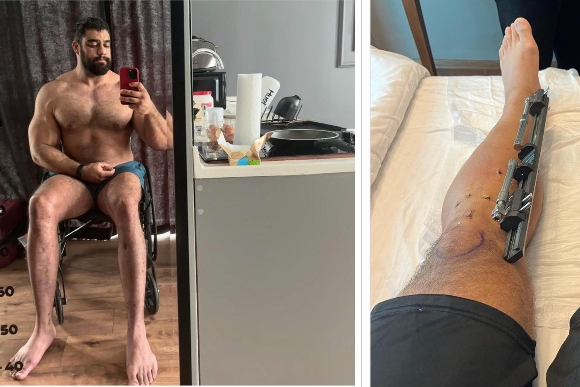 Anh chàng cơ bắp chi 100.000 USD để làm phẫu thuật cao hơn vợ