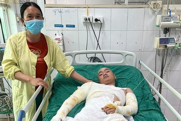 Góa phụ tuyệt vọng khi con trai bị bỏng nặng, nguy cơ phải cắt chân