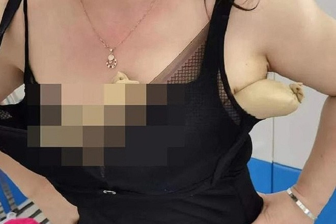Người phụ nữ bị bắt vì nhét 5 con rắn vào áo ngực để buôn lậu