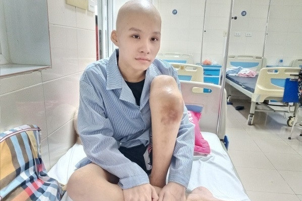 Em Bùi Văn Hà Như bị ung thư xương được ủng hộ hơn 35 triệu đồng