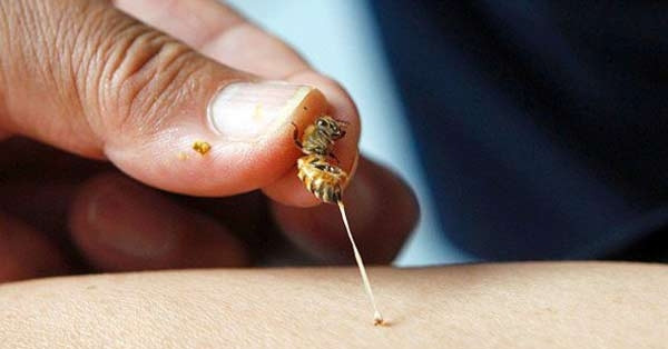 Tình trạng bệnh án ong đốt đã được ghi nhận ở Bệnh viện Sản Nhi Nghệ An như thế nào?
