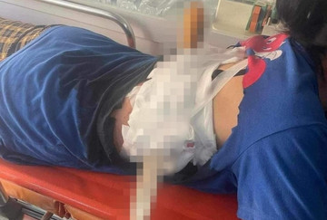 Bản tin trưa 23/7: Người phụ nữ ở Hà Tĩnh bị chồng phóng dao nhọn xuyên lưng