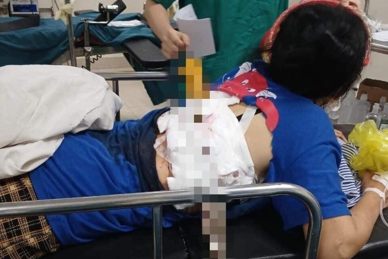 Sức khỏe người vợ bị chồng phóng dao xuyên lưng thế nào?