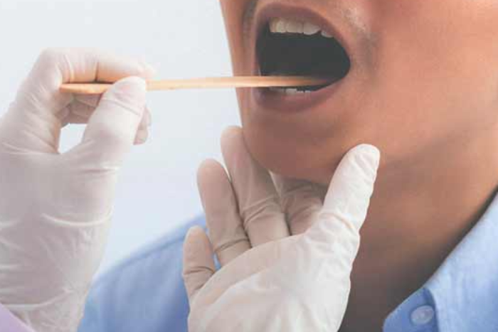 Dấu hiệu cảnh báo ung thư từ triệu chứng đau khi đánh răng