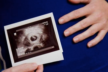 Bất ngờ khi bác sĩ báo có thai ở lách, thế giới chỉ mới phát hiện 39 ca