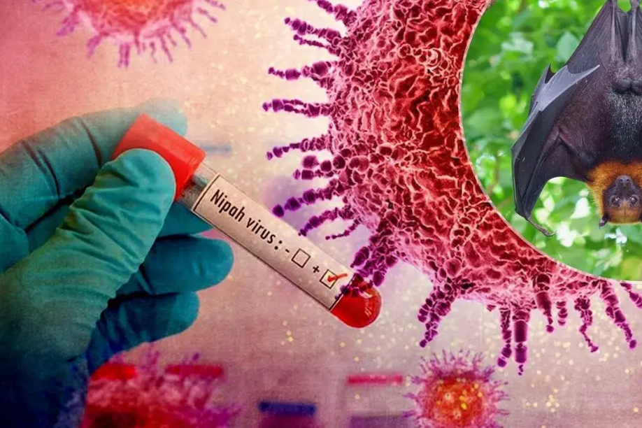 Những điều cần biết về virus Nipah có tỷ lệ tử vong lên tới 75%