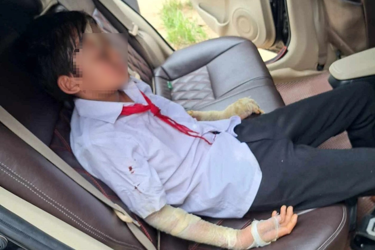 Nổ bóng bay trong lễ khai giảng ở Thanh Hóa, nhiều học sinh bị bỏng