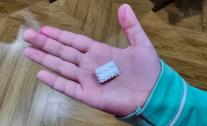 Dị vật mắc kẹt đường thở trẻ suốt 13 tháng Sai lầm thường gặp khi sơ cứu hóc dị vật khiến trẻ có thể tử vong