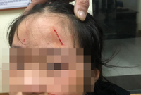 Bản tin sáng 27/1: Thực hư thông tin nữ sinh Hà Nội bị rạch mặt tại trường học