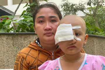 Bé gái bị biến dạng khuôn mặt do mắc bệnh ung thư hiếm gặp