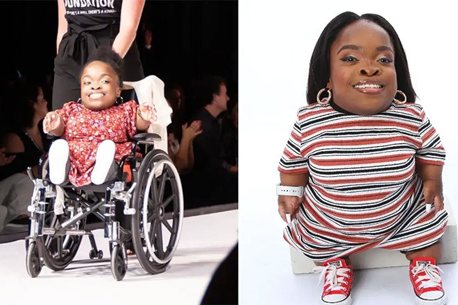 Người mẫu chuyên nghiệp thấp nhất thế giới, cao 72 cm tự tin trên sàn diễn