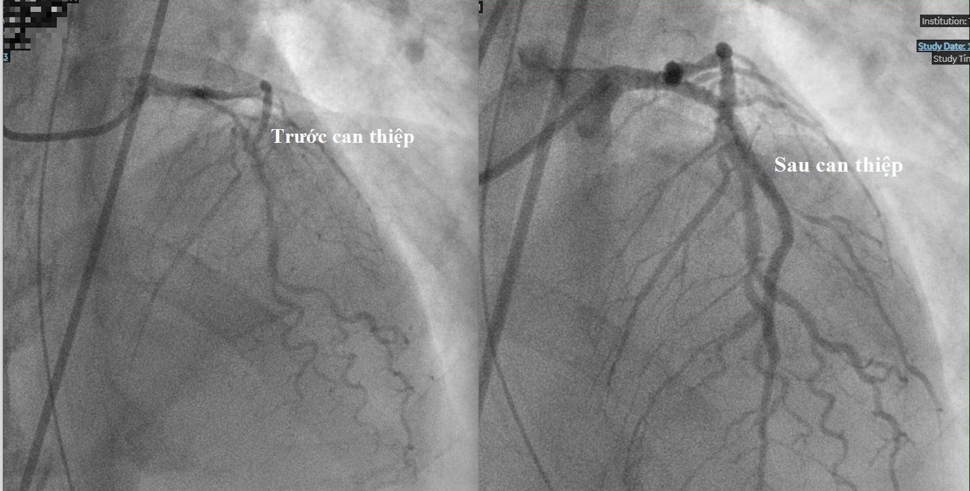 can thiep BV Trung Vuong.png