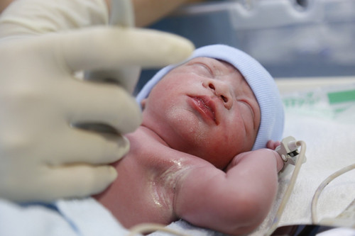 Em bé đầu tiên ở Việt Nam được sửa tim khi còn nằm trong bụng mẹ chào đời