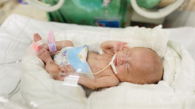 Tough but joyful journey of saving premature born infants