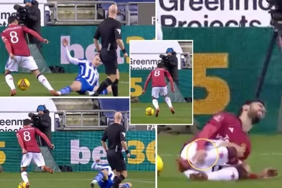 Bruno Fernandes khiến MU mang tiếng xấu dù thắng ở FA Cup