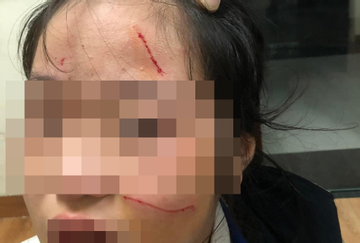 Bản tin chiều 3/2: Nữ sinh Hà Nội đánh em lớp dưới chảy máu mặt bị buộc thôi học