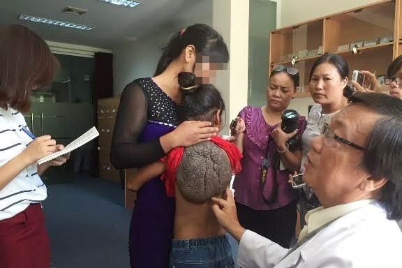 Căn bệnh hiếm gặp, thế giới có vài ca gồm một người Việt Nam