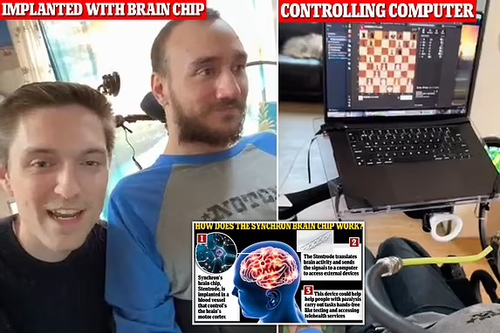 Bệnh nhân cấy chip não Neuralink chơi cờ vua trên laptop
