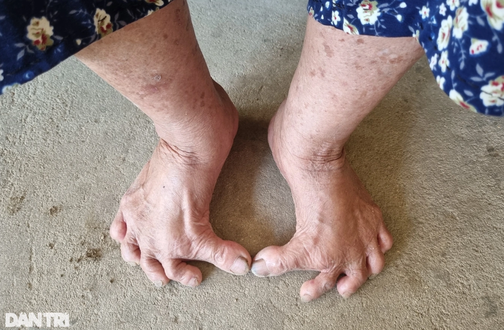 anh 2 cu ba co doi chan ky la.png