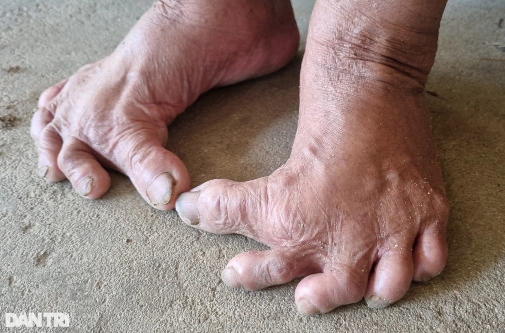 anh 4 cu ba co doi chan ky la.png