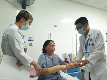 Doctor treats leprosy patients’ pain