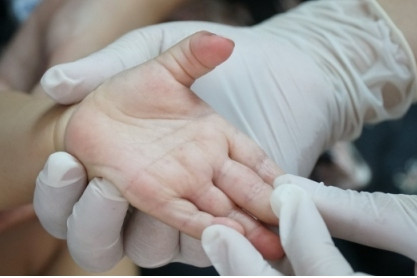 Cases of hand-foot-mouth disease rocketing nationwide
