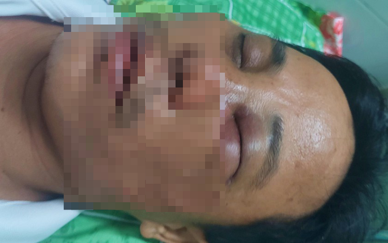thay hieu pho bi hanh hung o binh thuan 371.png