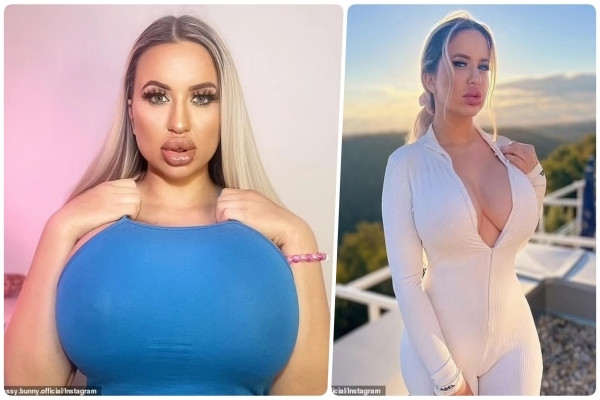 Cô gái bị gia đình từ mặt sau khi chi 1,6 tỷ đồng phẫu thuật thẩm mỹ