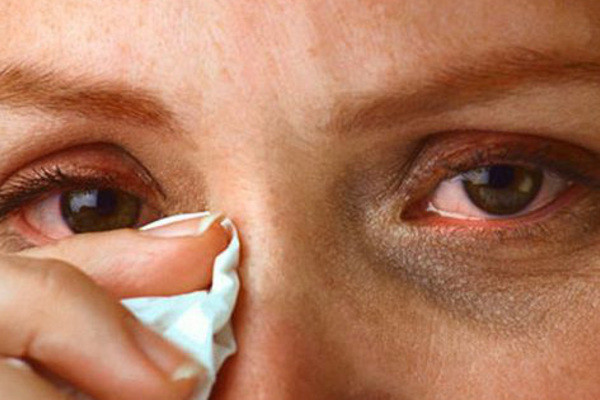 Có phải mắt đỏ là triệu chứng phổ biến khi bị mắc COVID-19 hay chỉ xuất hiện ở một số trường hợp?
Được việc!