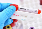 Biến chứng Covid-19 kéo dài hơn 1 năm của nữ y tá 31 tuổi