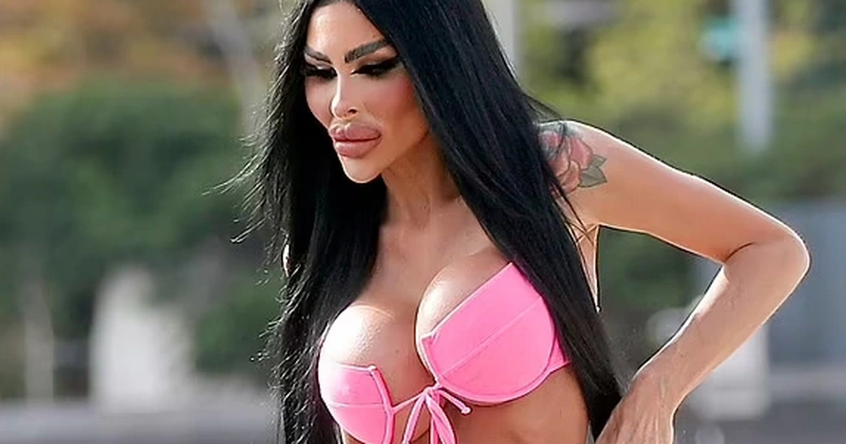 Người mẫu 'nghiện dao kéo' chi 135.000 USD cho 5 lần nâng ngực