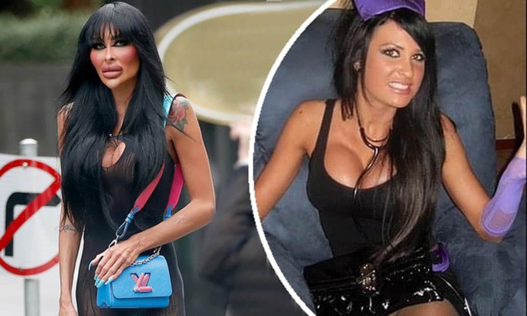 Người mẫu nghiện dao kéo chi 135.000 USD cho 5 lần nâng ngực - 2