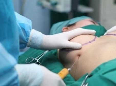 Investigate the cause of a woman in Ho Chi Minh City who died after breast augmentation