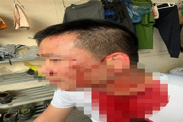 Tài xế bị nhóm 'cò' đánh ngay tại bến xe ở Hà Nội vì tự ý bắt khách