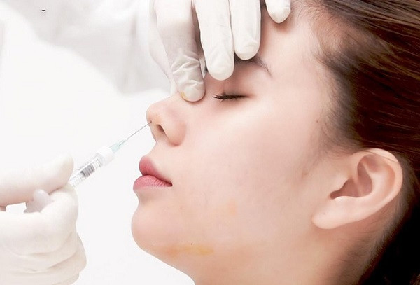 Tiêm thử filler làm đẹp, người phụ nữ hoại tử cả vùng mũi