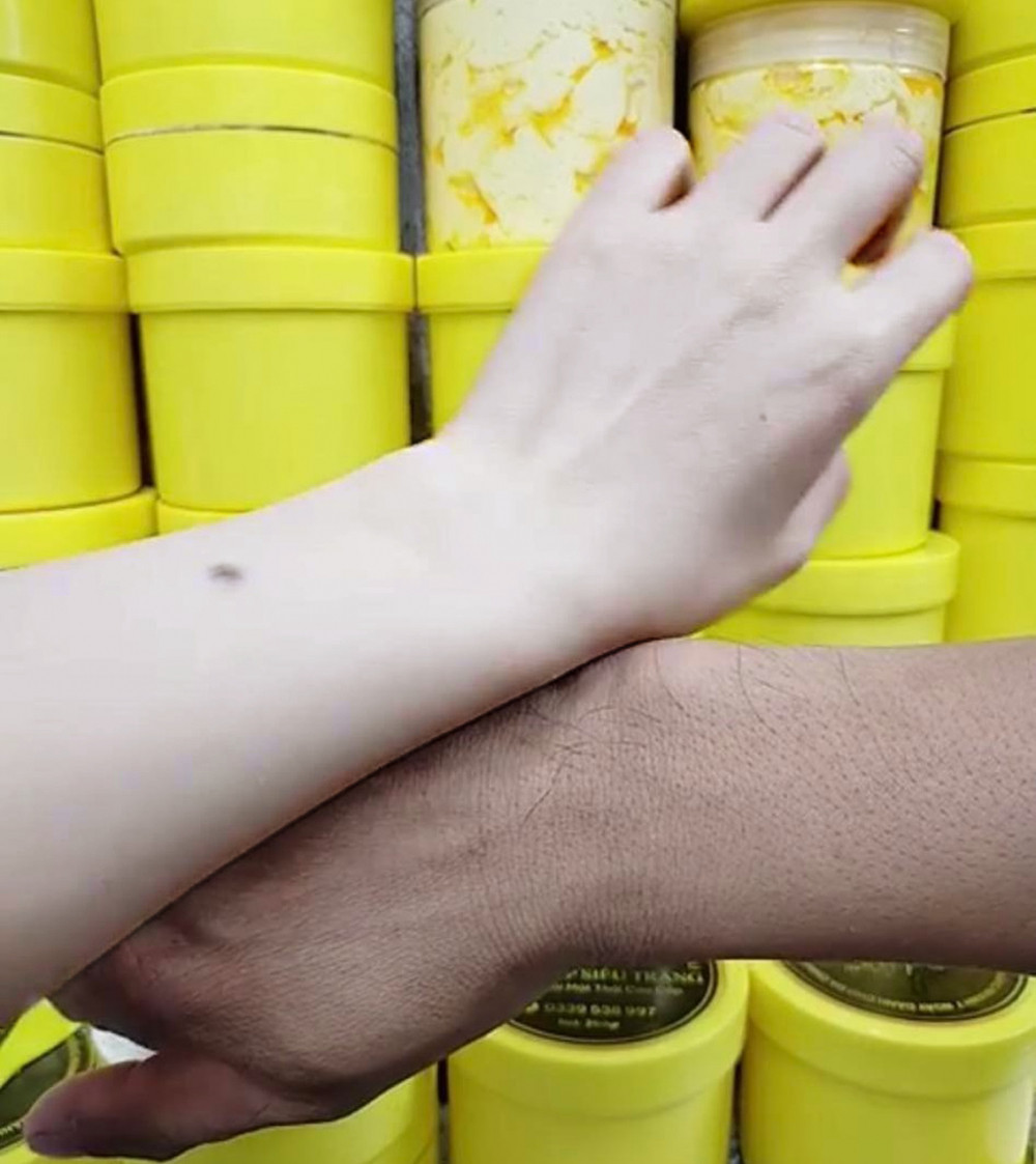 Một người bán livestream chứng minh da tay trắng nõn sau khi bôi kem trộn để hấp dẫn người mua