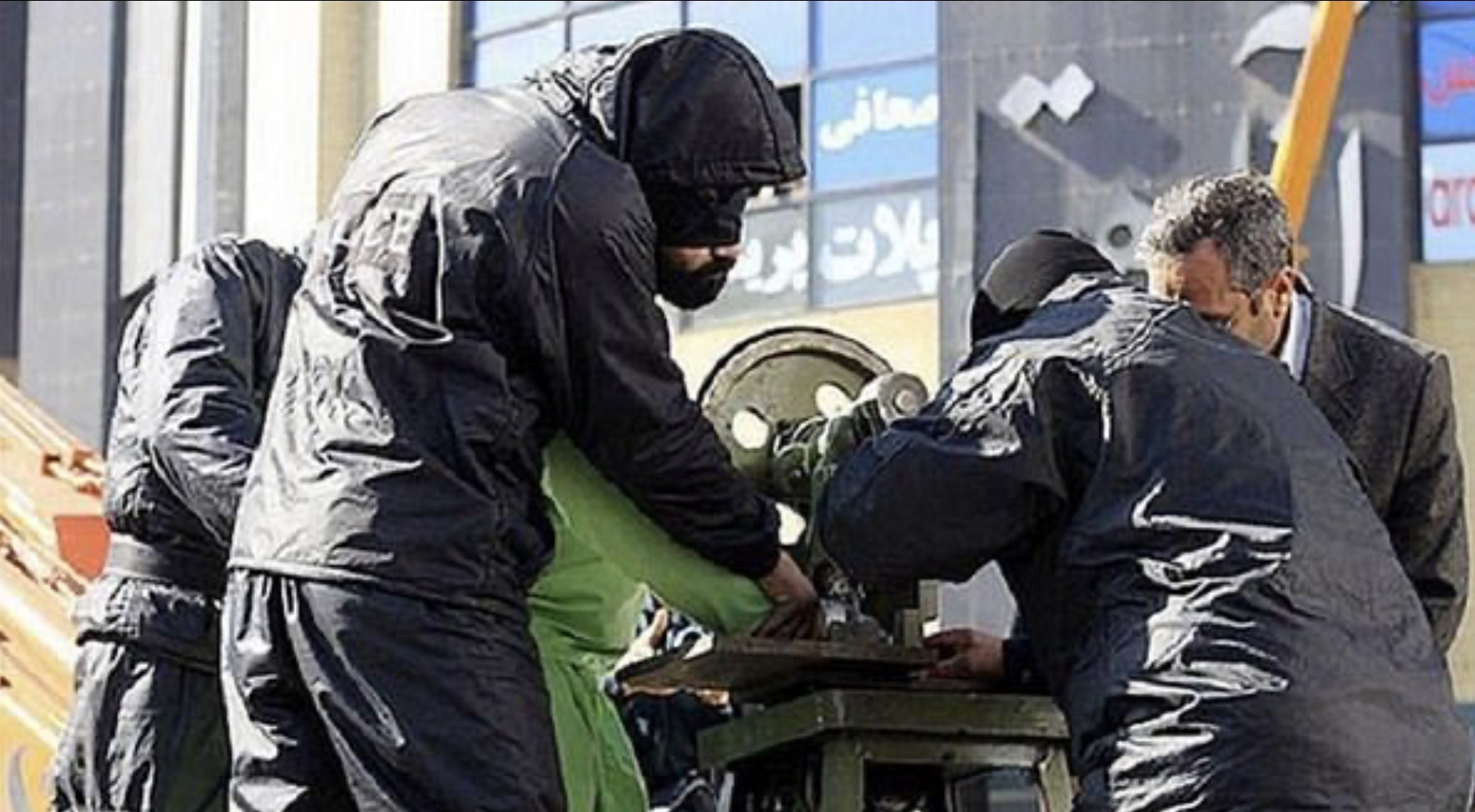 cắt cụt tay - daily mail