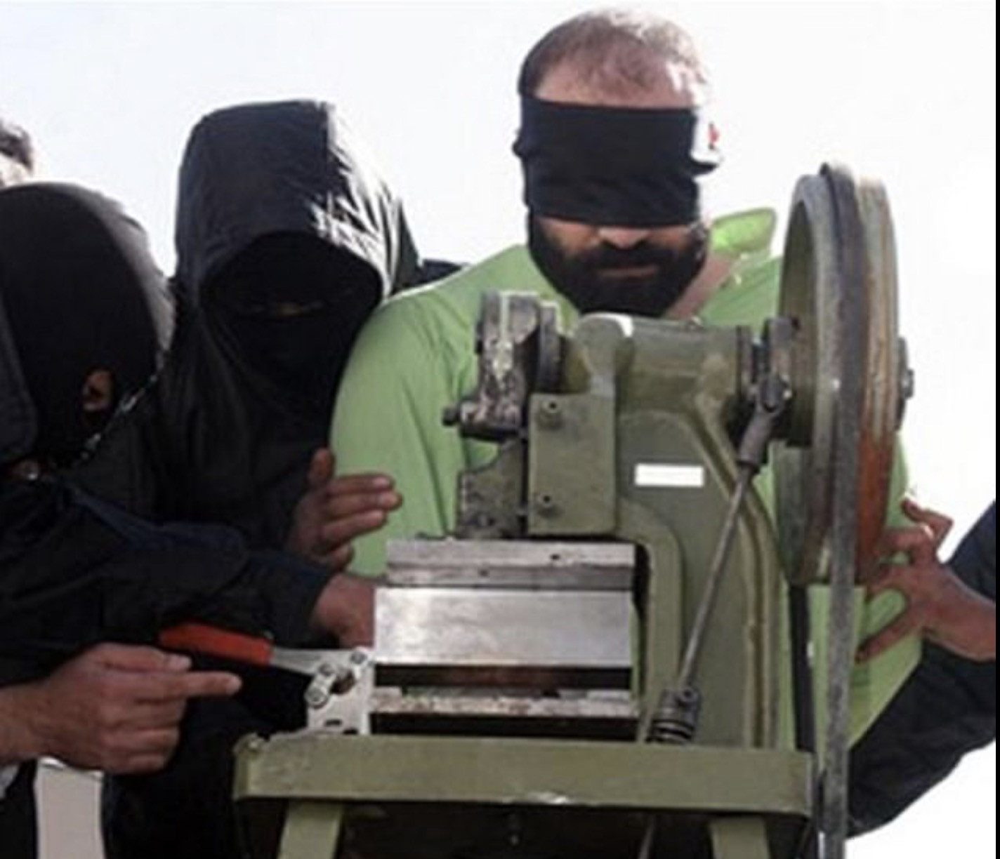 cắt cụt tay - daily mail