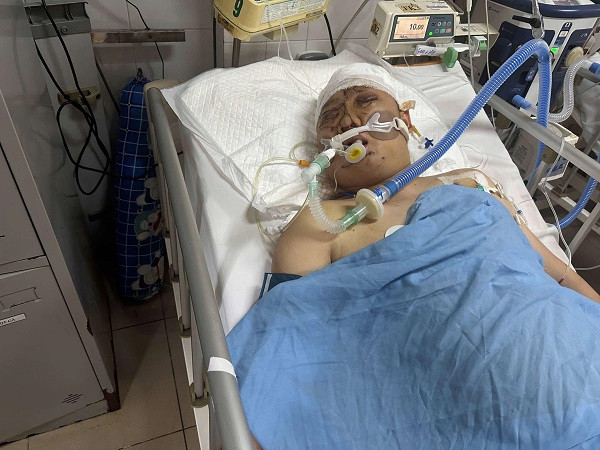 1ceab613 c1af 401d 87d9 0665bdaecb68.jpg