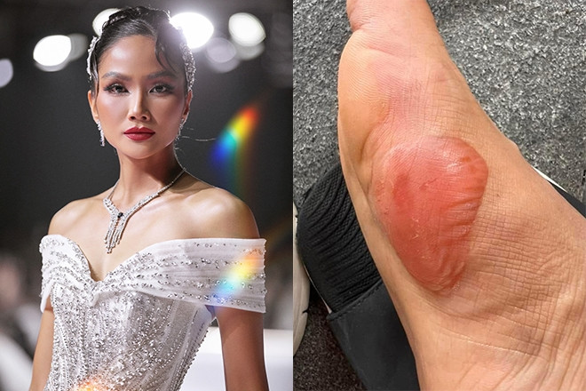 Chân sưng phồng, H'Hen Niê nén cơn đau diễn catwalk tự tin