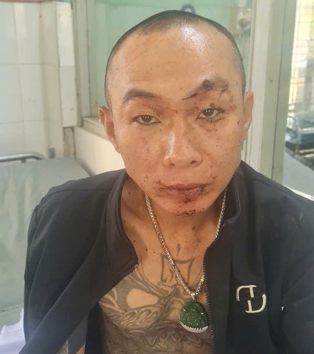 Nổ súng bắn trả cảnh sát khi bị phát hiện tụ tập sử dụng ma túy.jpg