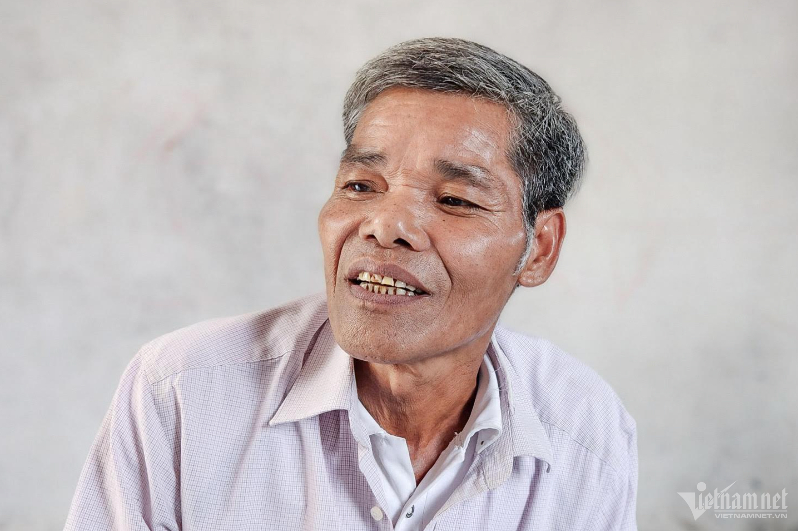 W-tin chi carbon.png